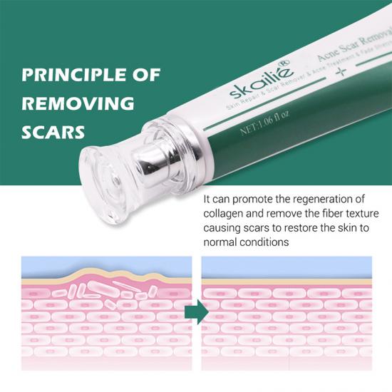0becb1eb30c73785eb33e80c9f93d888_medium Acne Scar Removal Cream Manufacturers,Professional Skincare Product Manufacturers - Image 4