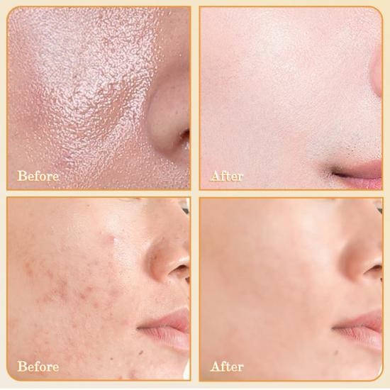 149134d566f893ea754d63d0e935913f_medium Turmeric Bubble Cleansing Mousse - Image 3