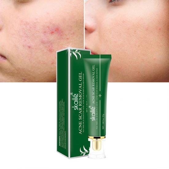 1f33ee418a67922b20656b9b13467dbe_medium Acne Scar Removal Gel Manufacturers,Professional Skincare Product Manufacturers - Image 3