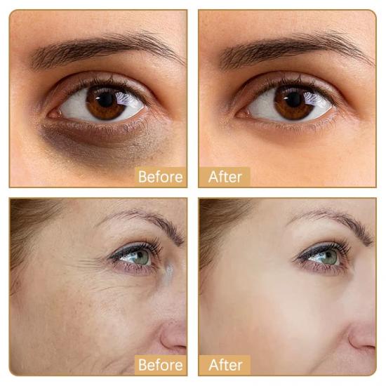 24146c4fed71dcf41a83aa345d918f04_medium Eye Firming Dark Circle Removing Serum - Image 5