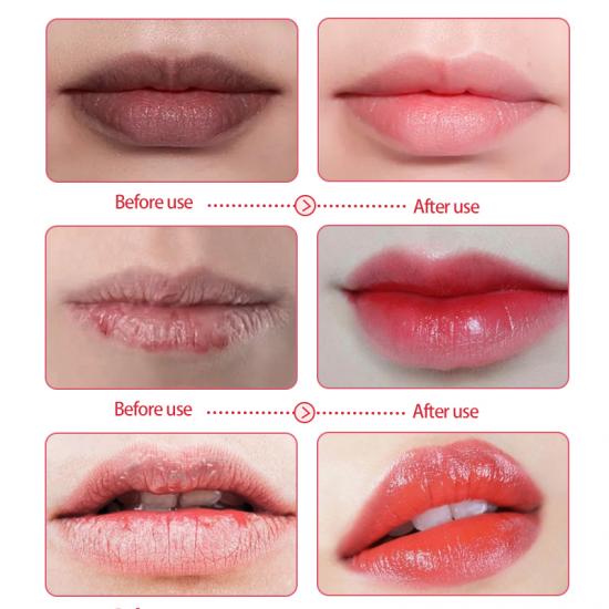38132eabefb5610980f0a9835854f0ad_medium Skailie Pink Collagen Lip Mask Manufacturers,Professional Skincare Product Manufacturers - Image 5