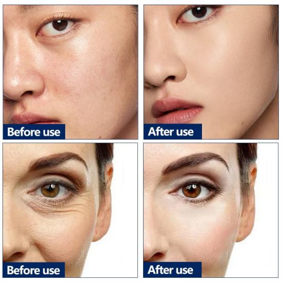 4188be613340996af271b20cc75d8fe5_medium Blue Copper Peptide Repairing Serum Manufacturers,Professional Skincare Product Manufacturers - Image 2