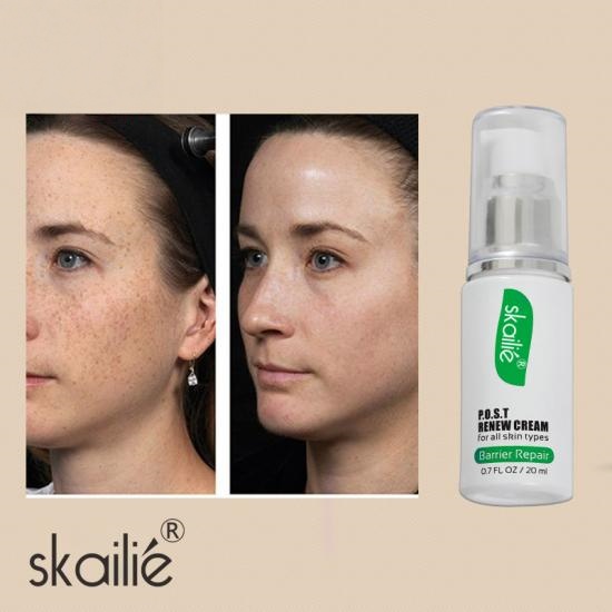462c509398a845b4f29248cc97c06222_medium Damaged Skin Repair Renew Cream Manufacturers,Professional Skincare Product Manufacturers - Image 3