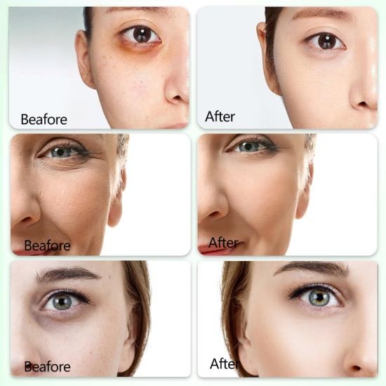 51d901e70f9db7766ef2ee7490fb01c9_medium-2 Skailie Aloe Vera Collagen Eye Mask Manufacturers,Professional Skincare Product Manufacturers - Image 2