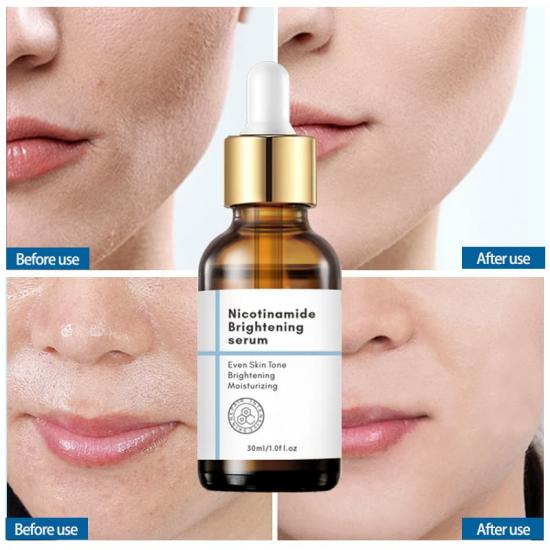 5602fecde5cb9095ad46ae9fbcd45cad_medium Nicotinamide Whitening Serum - Image 4