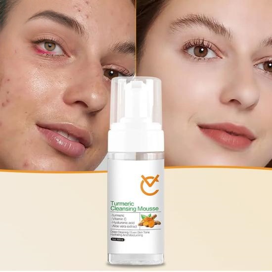 57f9da428fdd2eff61686dd3a1ec06a9_medium Turmeric Bubble Cleansing Mousse - Image 2