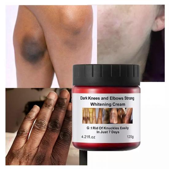 Skailie Knees And Elbows Whitening Cream Manufacturers,Professional Skincare Product Manufacturers