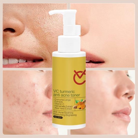 62fae109913dda6791f691244506cb9d_medium VC Turmeric Acne Face Toner - Image 4