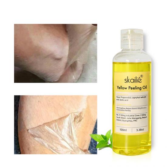 70c0b870fe537dda8b07c08c7715415d_medium Skailie Yellow Peeling Oil Manufacturers,Professional Skincare Product Manufacturers - Image 3