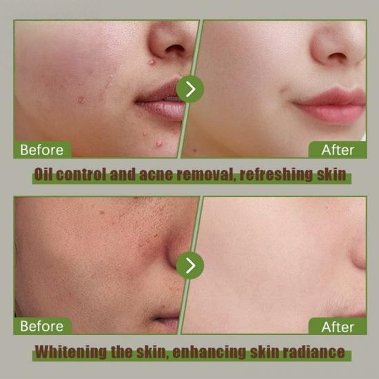 7e71b9b8561ef88b9c9c8312a36078cc_medium Turmeric VC Mud Facial Mask - Image 5