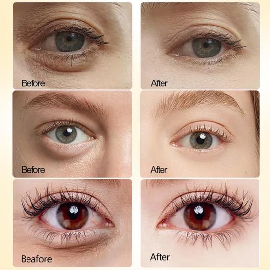 7fdbeaa2d2cac7d94ddf7b52410745f6_medium-1 Skailie Wing Oranges Collagen  Eye Mask Manufacturers,Professional Skincare Product Manufacturers - Image 6