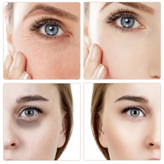 80f1f6e2600d67b73c2984652e38d91c_medium Skailie Cloud Collagen Eye Mask Manufacturers,Professional Skincare Product Manufacturers - Image 5