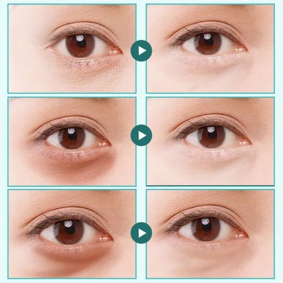 83888093ef5b8d0fcb989554f51e3019_medium Private Label Moisturizing Collagen  Eye Mask Manufacturers,Professional Skincare Product Manufacturers - Image 6
