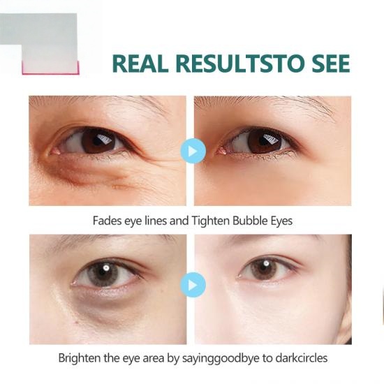 88e0f1c4e0db075dc5e1c6a463c41996_medium Skailie Heart Shape Collagen Eye Mask Manufacturers,Professional Skincare Product Manufacturers - Image 6