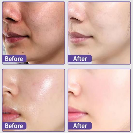 8a58ad50aa3d420951a29b2d2000022d_medium Custom Sunscreen Spf30 Manufacturers,Professional Skincare Product Manufacturers - Image 4