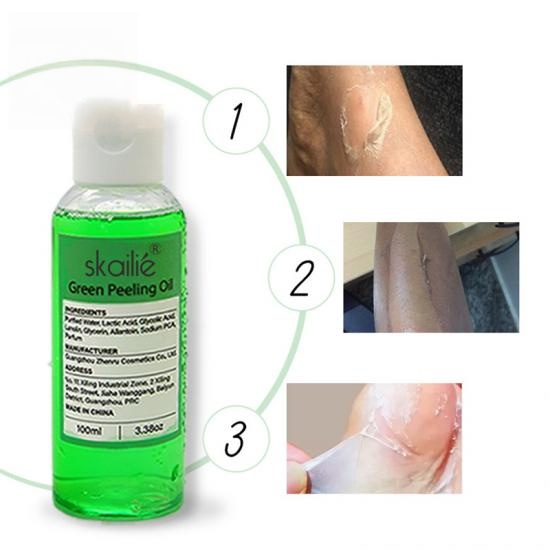 8c39bc9b7e98801625c1b5ef0382b37d_medium Skailie Green Peeling Oil Manufacturers,Professional Skincare Product Manufacturers - Image 2