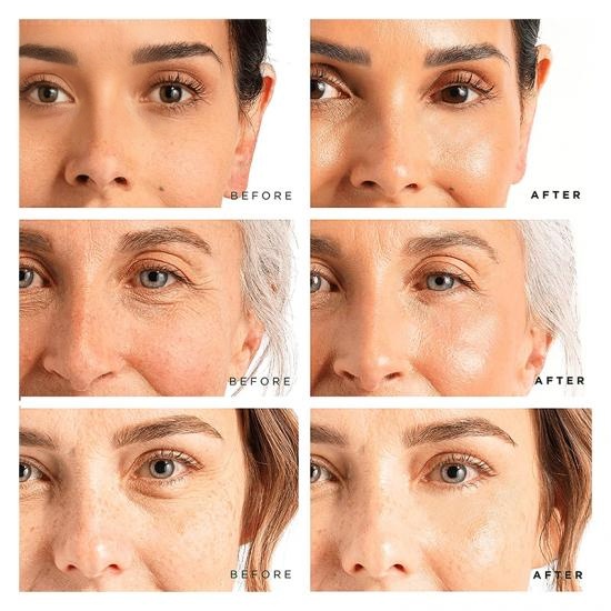 9f4725d316287a4f1c429f2fb0533e08_medium Anti Aging Vitamin C Serum Manufacturers,Professional Skincare Product Manufacturers - Image 6