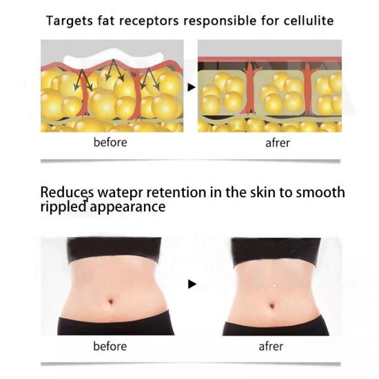 a65c39a7f0ccec29c6de453e700190b1_medium Skailie Women Slimming Cream Manufacturers,Professional Skincare Product Manufacturers - Image 5