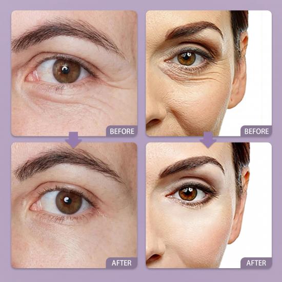 aa86307e8d026a19d7bdbf3b00b59eeb_medium MATRIXYL 3000 anti aing face serum Manufacturers,Professional Skincare Product Manufacturers - Image 5