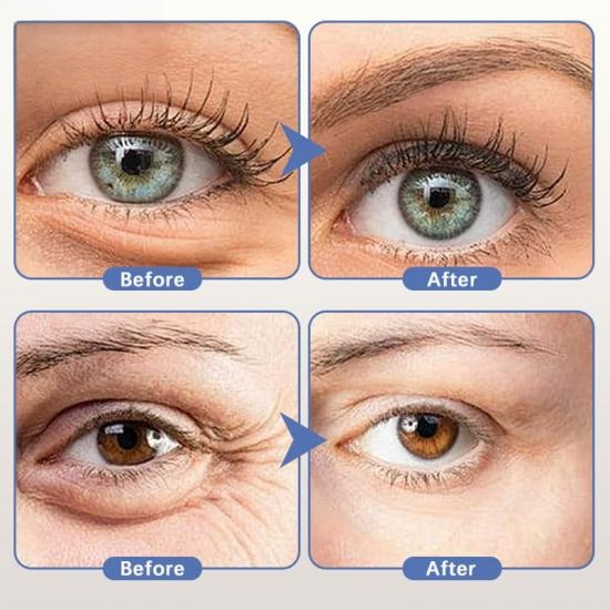 ab0e48c8bf64936da8757b387e63d4de_medium Instant Anti-wrinkle Eye Cream - Image 6