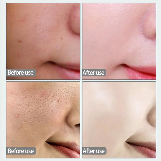 b446639898922974a367fb6572b0c51d_medium Hyaluronic Acid Collagen Face Mask Manufacturers,Professional Skincare Product Manufacturers - Image 5