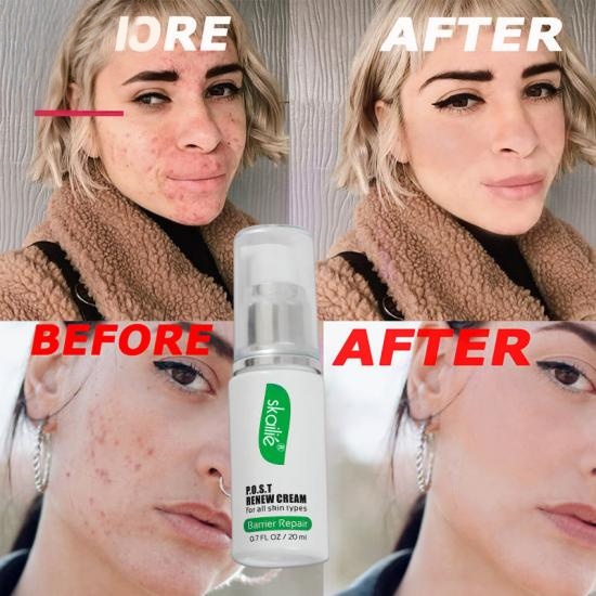 bba42ce28071aa8fde218f8fb89f0aaf_medium Damaged Skin Repair Renew Cream Manufacturers,Professional Skincare Product Manufacturers - Image 4