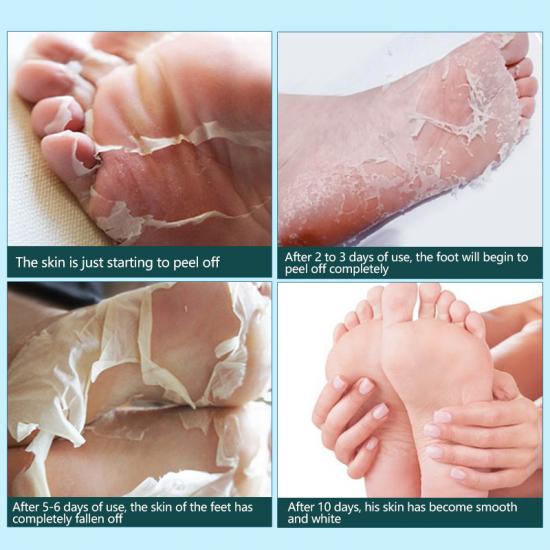 be4a1f624375135b6b685bbf17dbd4ea_medium coconut exfoliating foot mask Manufacturers,Professional Skincare Product Manufacturers - Image 5
