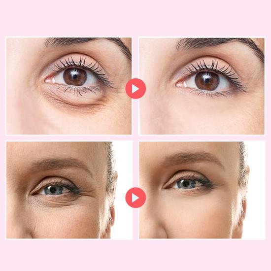 c00f3b90dd73ee79a3208d5626314cb7_medium Skailie Rose  Collagen Wing Eye Mask Manufacturers,Professional Skincare Product Manufacturers - Image 3