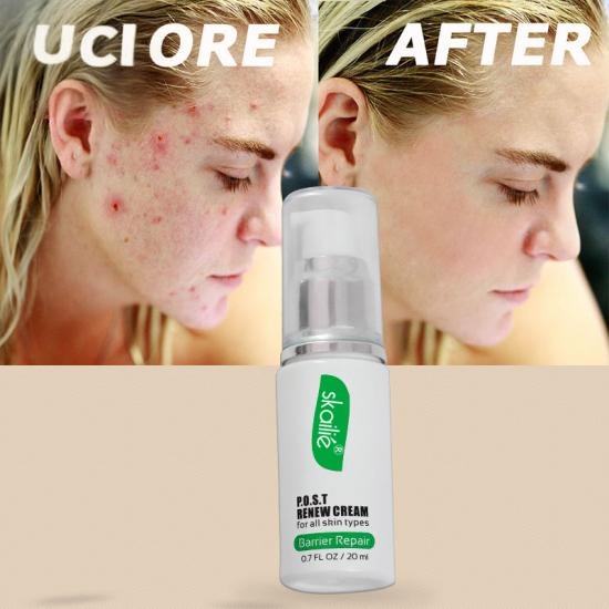 cc80d26bdb822b5d3962f3e7c28bf58d_medium Damaged Skin Repair Renew Cream Manufacturers,Professional Skincare Product Manufacturers - Image 5