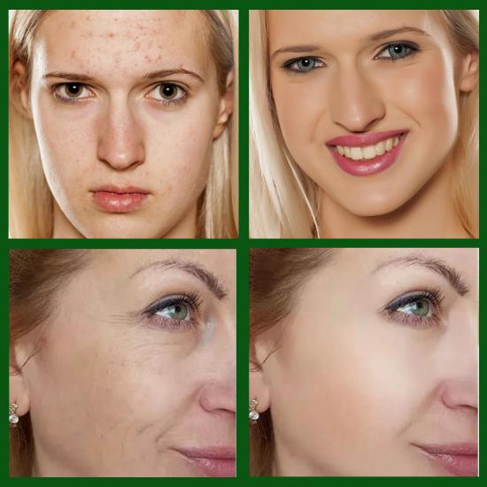cd5b3915b467abce99122931af633573_medium Hemp Seed Oil Hydrating Face Care Set Manufacturers,Professional Skincare Product Manufacturers - Image 4