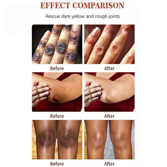 dacba752a1f1030ec3a3c08d673b1c61_medium Dark Spot Remover Cream Manufacturers,Professional Skincare Product Manufacturers - Image 3