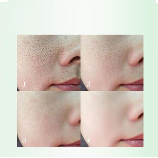 db7b00c84bb0f6ed372da077bf5d40d5_medium Tea Tree Pore Minimizer Serum Manufacturers,Professional Skincare Product Manufacturers - Image 3