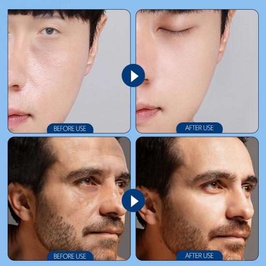 e70ce374a7fd1c11d8a2002bfa5c7ab5_medium Deep Moisturizing Oil-Control Light-weight Men Facial Cream Manufacturers,Professional Skincare Product Manufacturers - Image 5