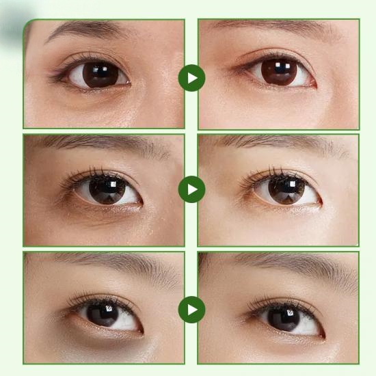 e9d693b998ccdd07f2529cb231bb3d03_medium Private Label Collagen Wing Eye Mask Manufacturers,Professional Skincare Product Manufacturers - Image 4