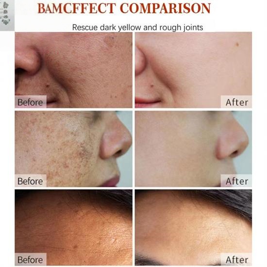 eb2b07c03f570e33652df2dda32551fb_medium Dark Spot Remover Cream Manufacturers,Professional Skincare Product Manufacturers - Image 2
