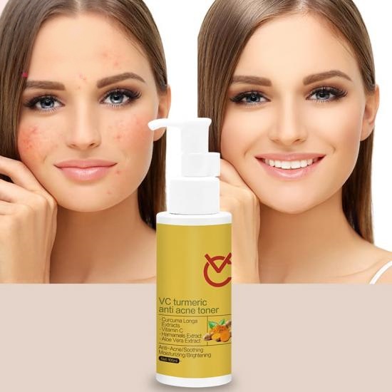 fa34bfeed343b1cc154fa7e325f0abf9_medium VC Turmeric Acne Face Toner - Image 5