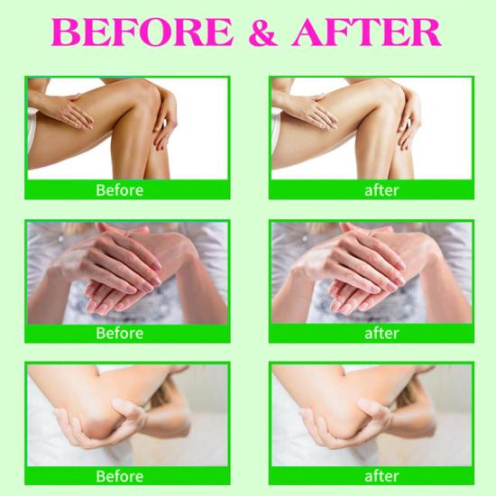 ff4c4e130ca4e18366d3d25f4eb2d6d7_medium Collagen Dark Spot Remover Cream Manufacturers,Professional Skincare Product Manufacturers - Image 4